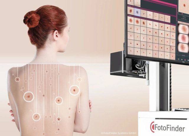 La L’Architect Clinic, prevenția devine standard cu tehnologia FotoFinder ATBM Master