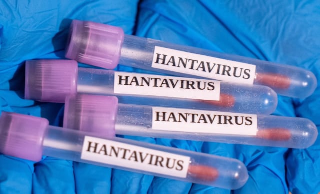 Un american de pe nava MV Hondius, depistat ușor pozitiv la testul PCR pentru hantavirusul Andes
