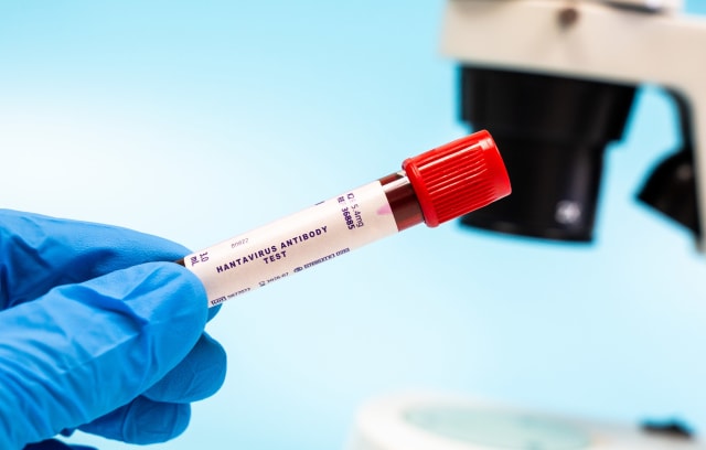 Institutul Cantacuzino a confirmat caz de hantavirus în România, pacient stabil