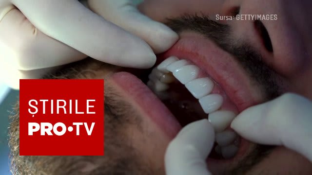 Colegiul Medicilor avertizează asupra promisiunilor false de tratament dentar: 'Dinți ficși în 24 de ore'