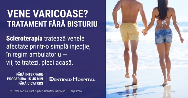 La Dentirad Hospital se tratează varicele fără bisturiu, internare sau cicatrici