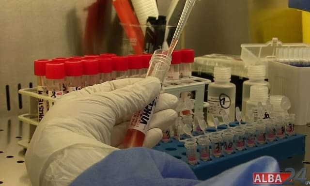 Celule imunitare NK atacând celule tumorale în laborator