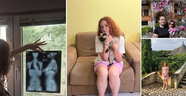 Antonia, o adolescentă de 16 ani din Bacău, trăiește cu dureri cumplite, iar familia mai are nevoie de 8.533 de euro pentru operație