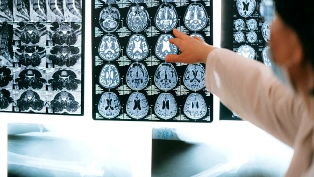 Creierul ajută spermatozoizii și ovulele să supraviețuiască la căldură, sugerează un studiu