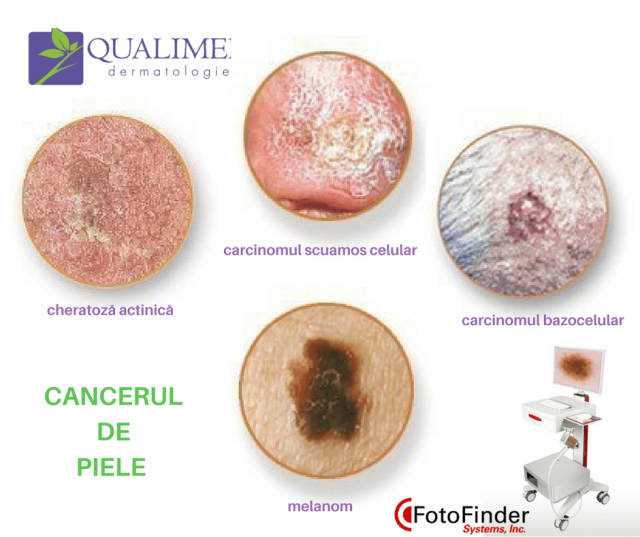 Medicul dermatolog examinează pielea pacientului în cabinet