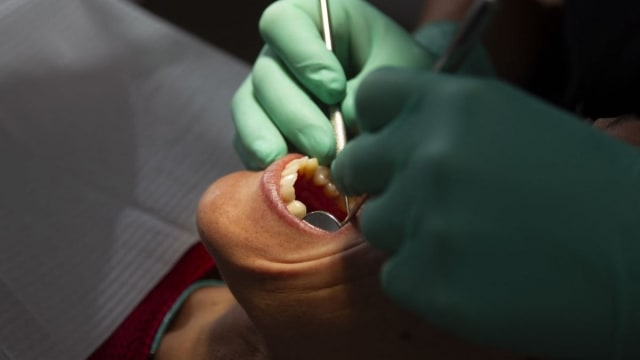 radiografie dentară cu umbră suspectă în maxilar