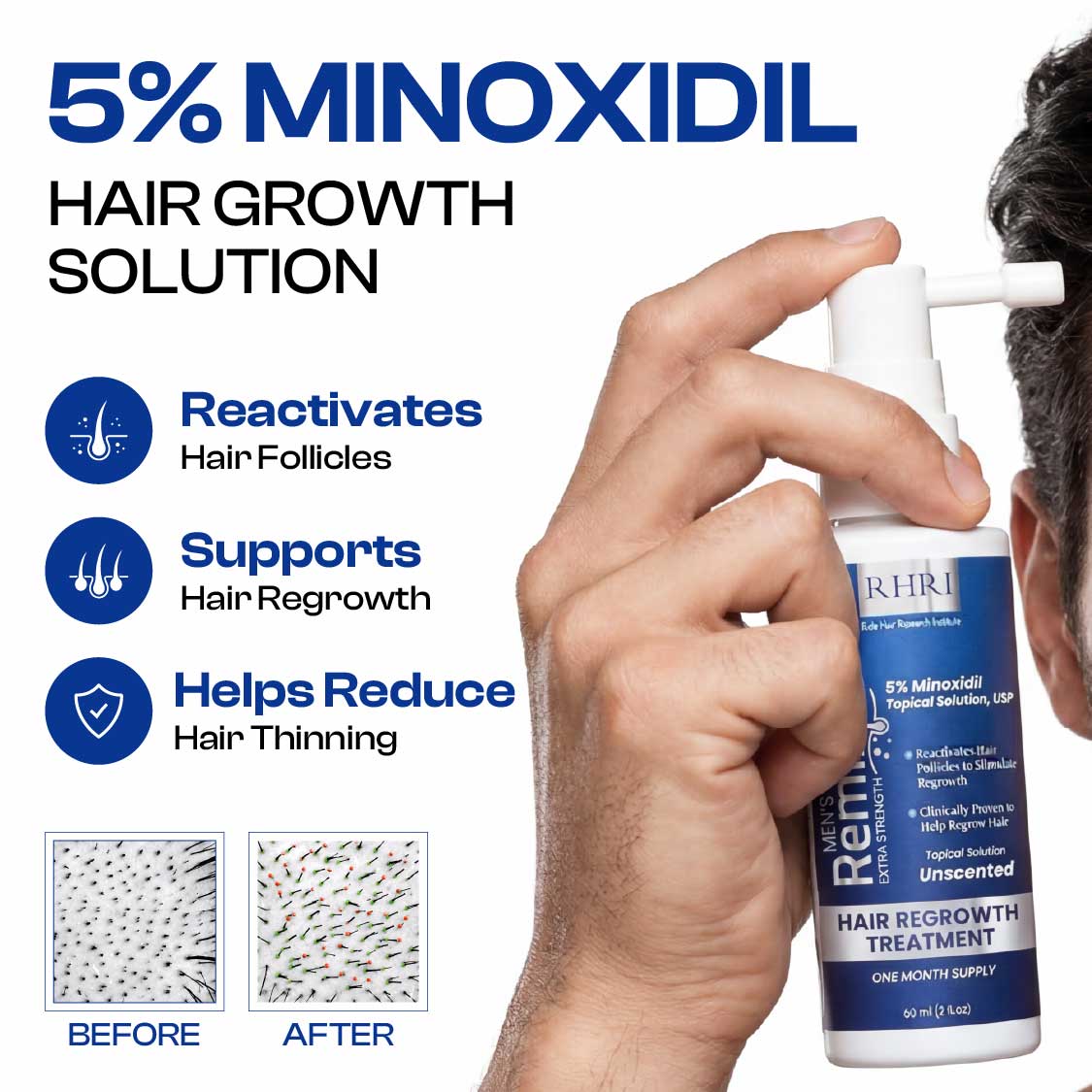 Features & Benefits
