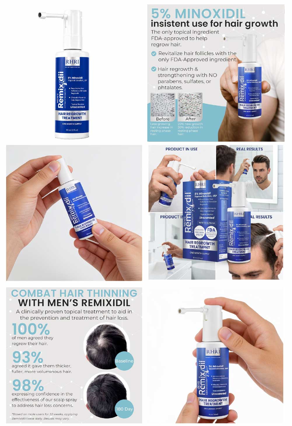 5% Minoxidil for Men Hair Regrowth Spray - before