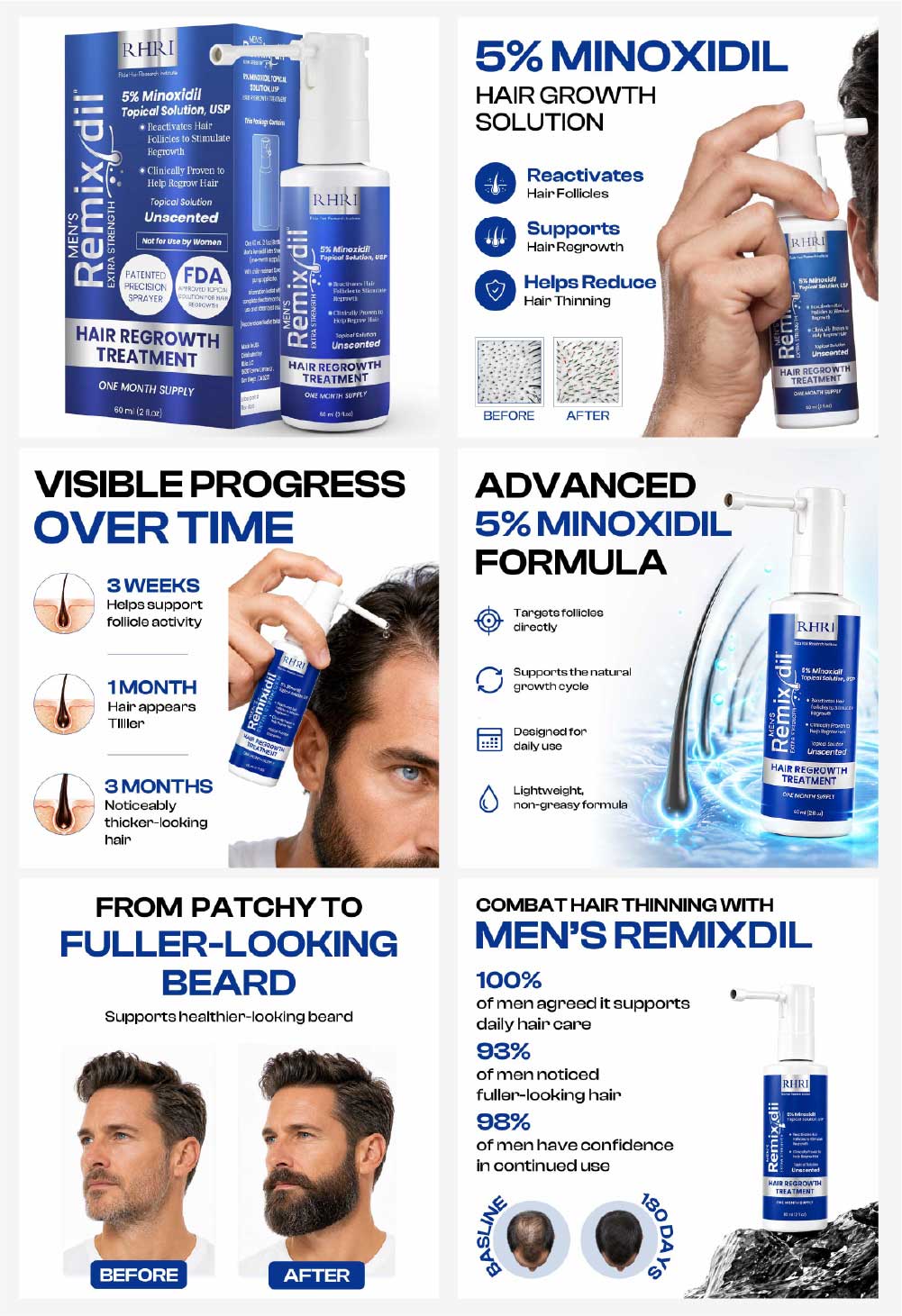 5% Minoxidil for Men Hair Regrowth Spray - after