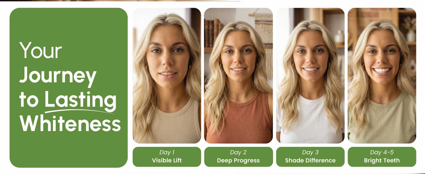 Your Whitening Journey