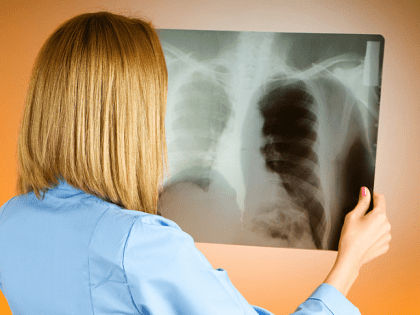 Жителей Тульской области пригласили на бесплатный онкоскрининг