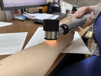 Жители Тульской области проверили родинки на онкологию