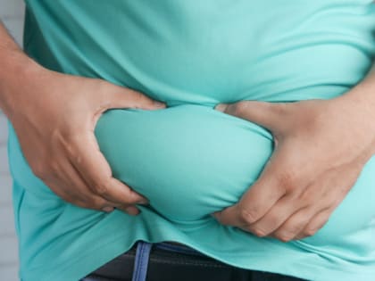 В России наблюдается рост числа мужчин с ожирением