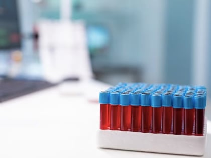 Больше 150 туляков сдали экспресс-тест на ВИЧ