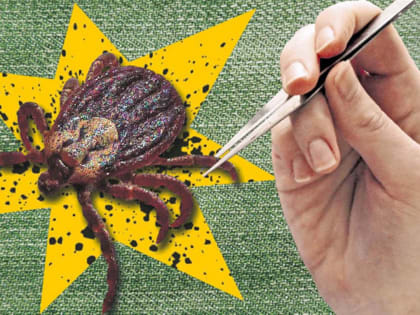 За 9 месяцев в Тульской области 18 человек заразились болезнью Лайма