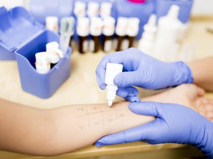 «Городские жители наибольше уязвимы, чем сельские»: тульский специалист Татьяна Сафронова ответила на семь вопросов об аллергии