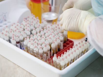 В Тульской области растет заболеваемость ОРВИ и гриппом: в районах частично закрыли детские сады и школы