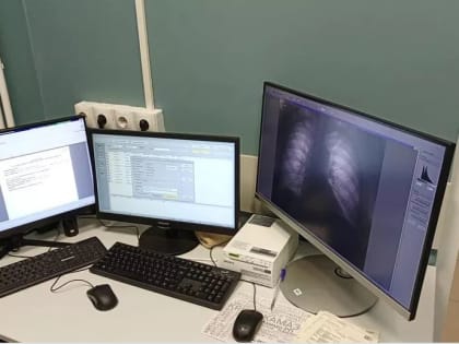 Пять цифровых флюорографов поступили в поликлиники Тульской области