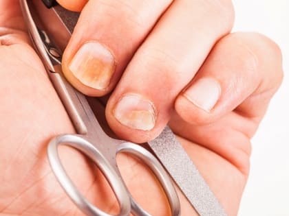 Грибок после маникюра: тульский врач рассказала об опасностях салонной процедуры