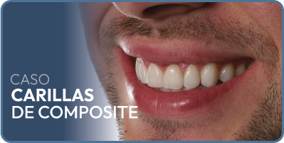 Caso implantes dentales carga inmediata