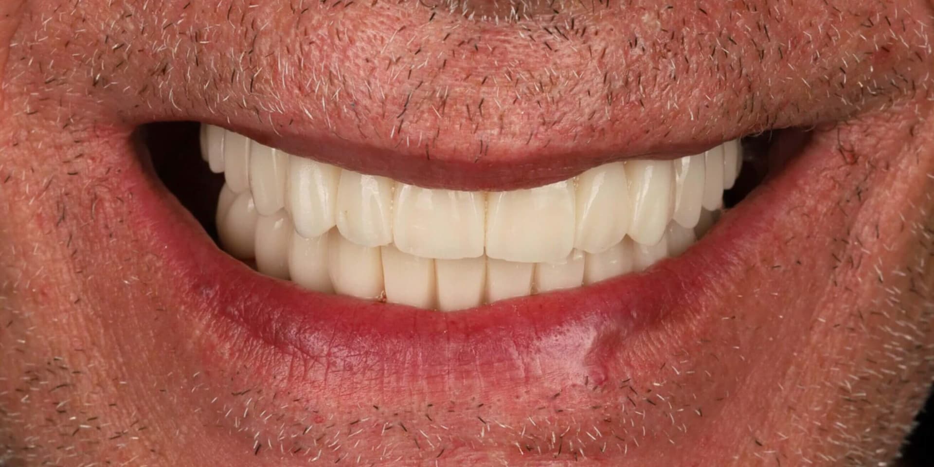 Después