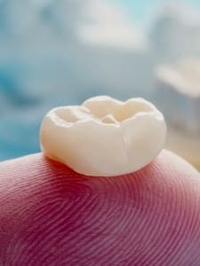 corona-circonio-vs-ceramica