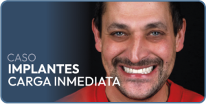 caso-implantes-dentales_8_xekssr