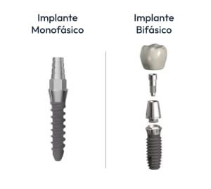 implante-monofasico-o-monobloc_z5lblb