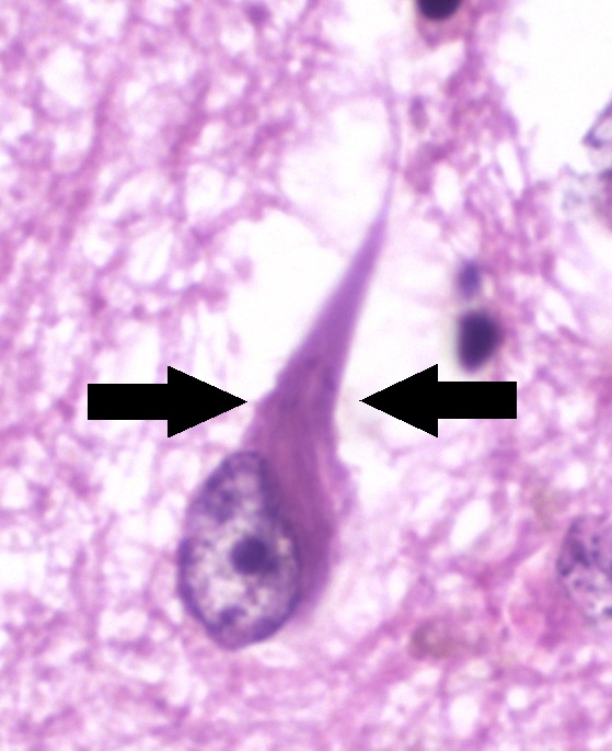 Image for question 2
