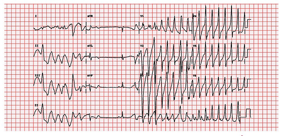 Image for question 1