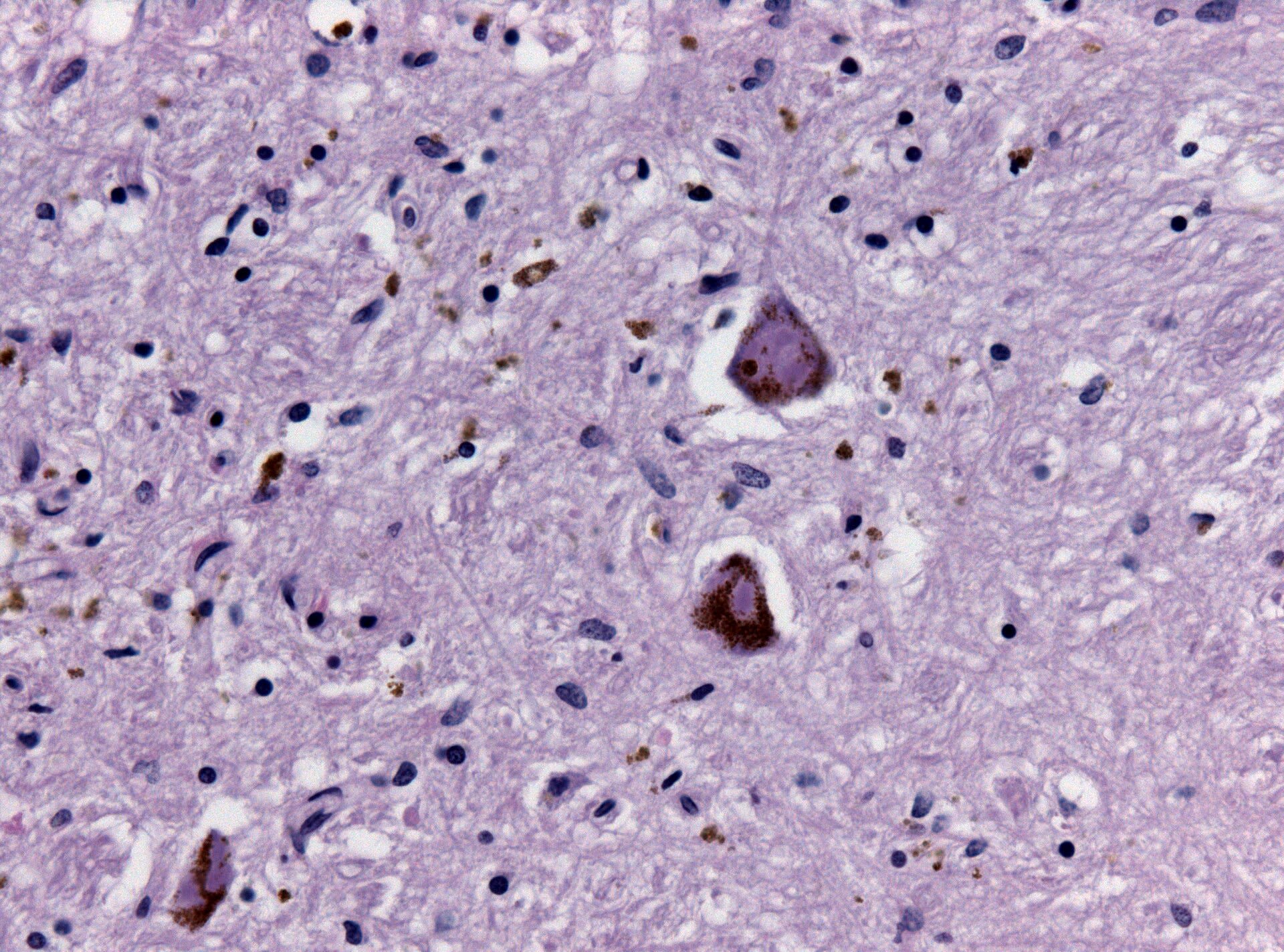 Image for question 1