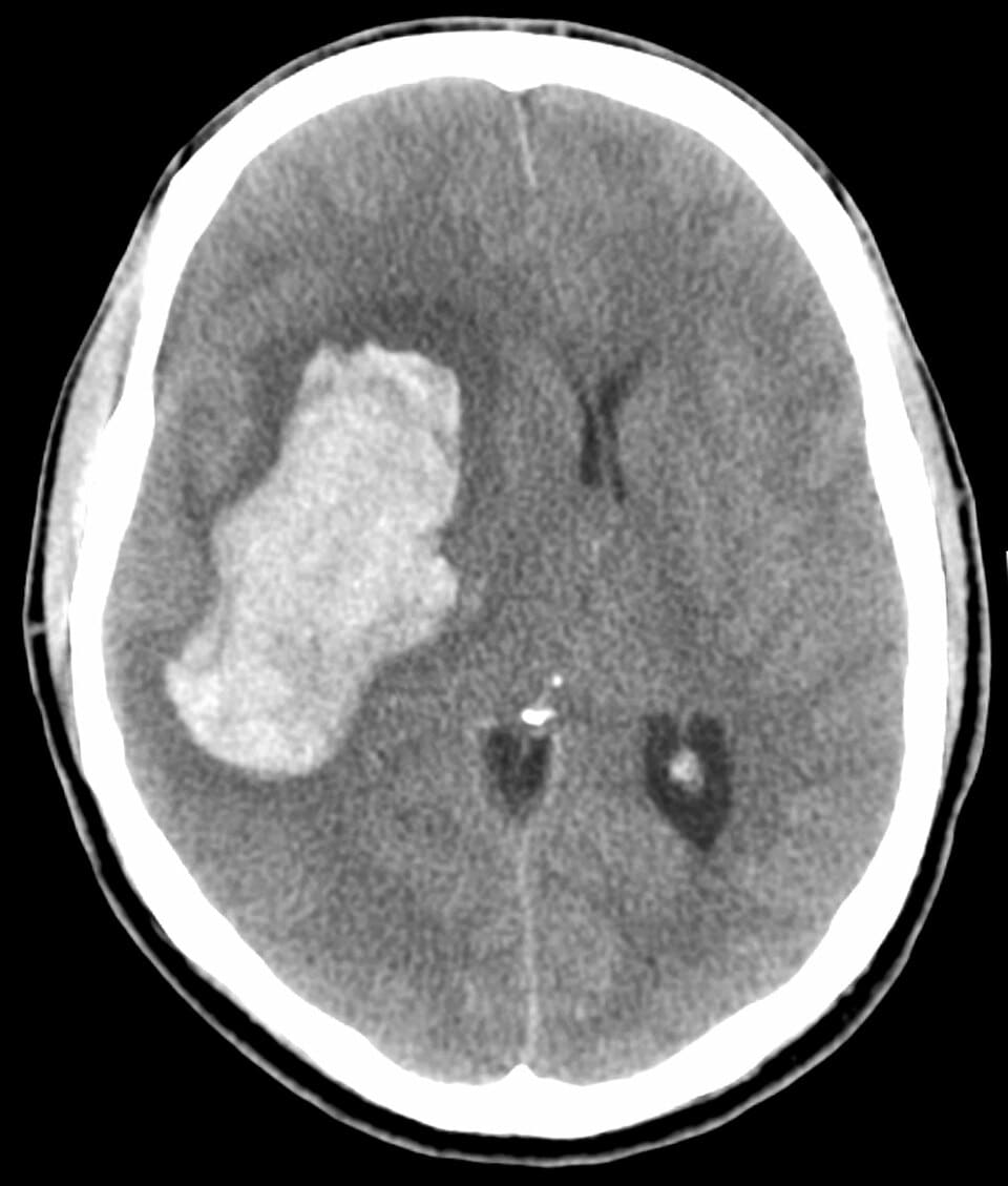 Image for question 2