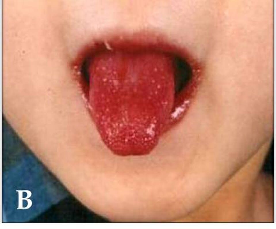 Image for question 1