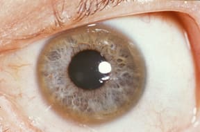 Image for question 1
