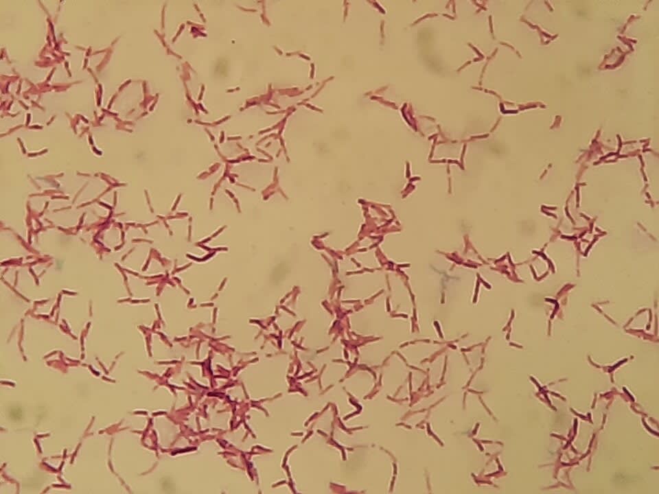 Image for question 1