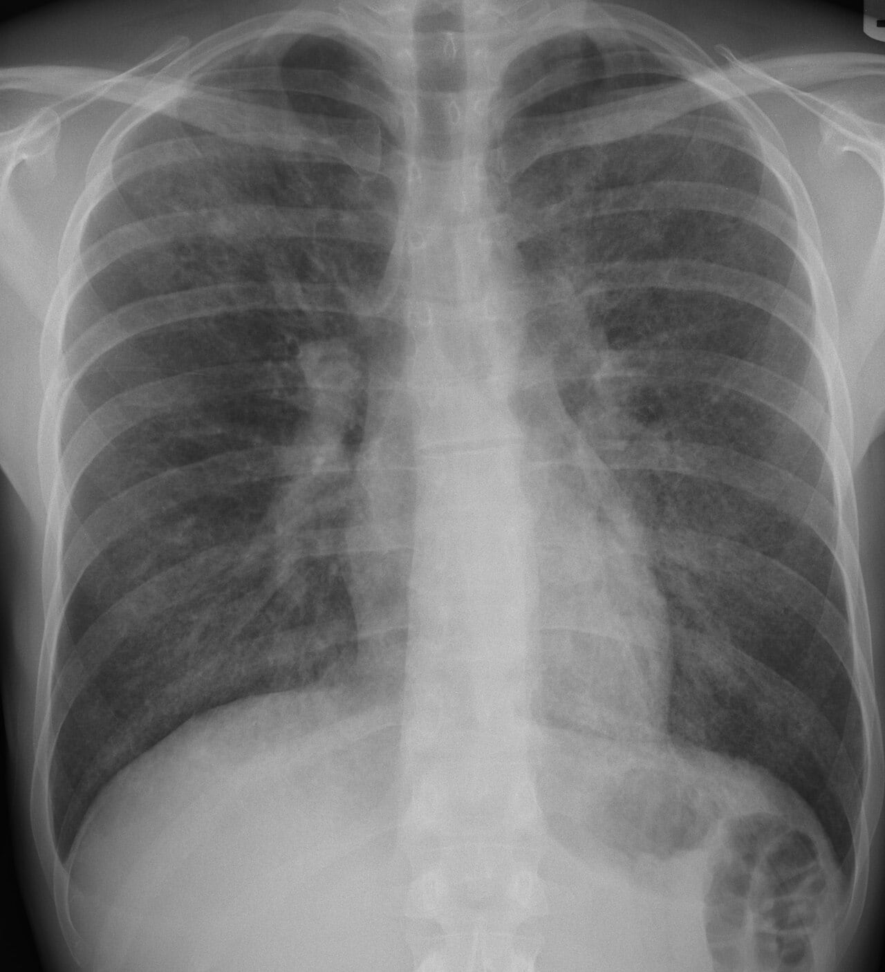 Image for question 1