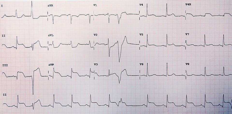 Image for question 1