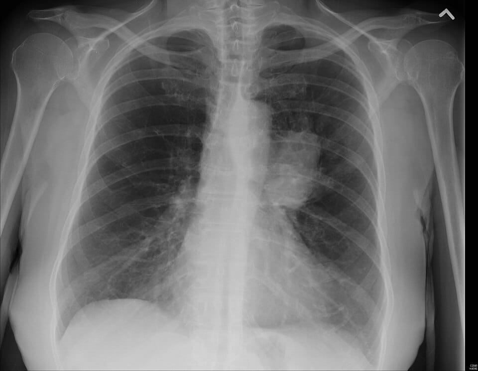 Image for question 2