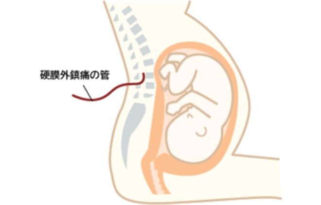 特長1