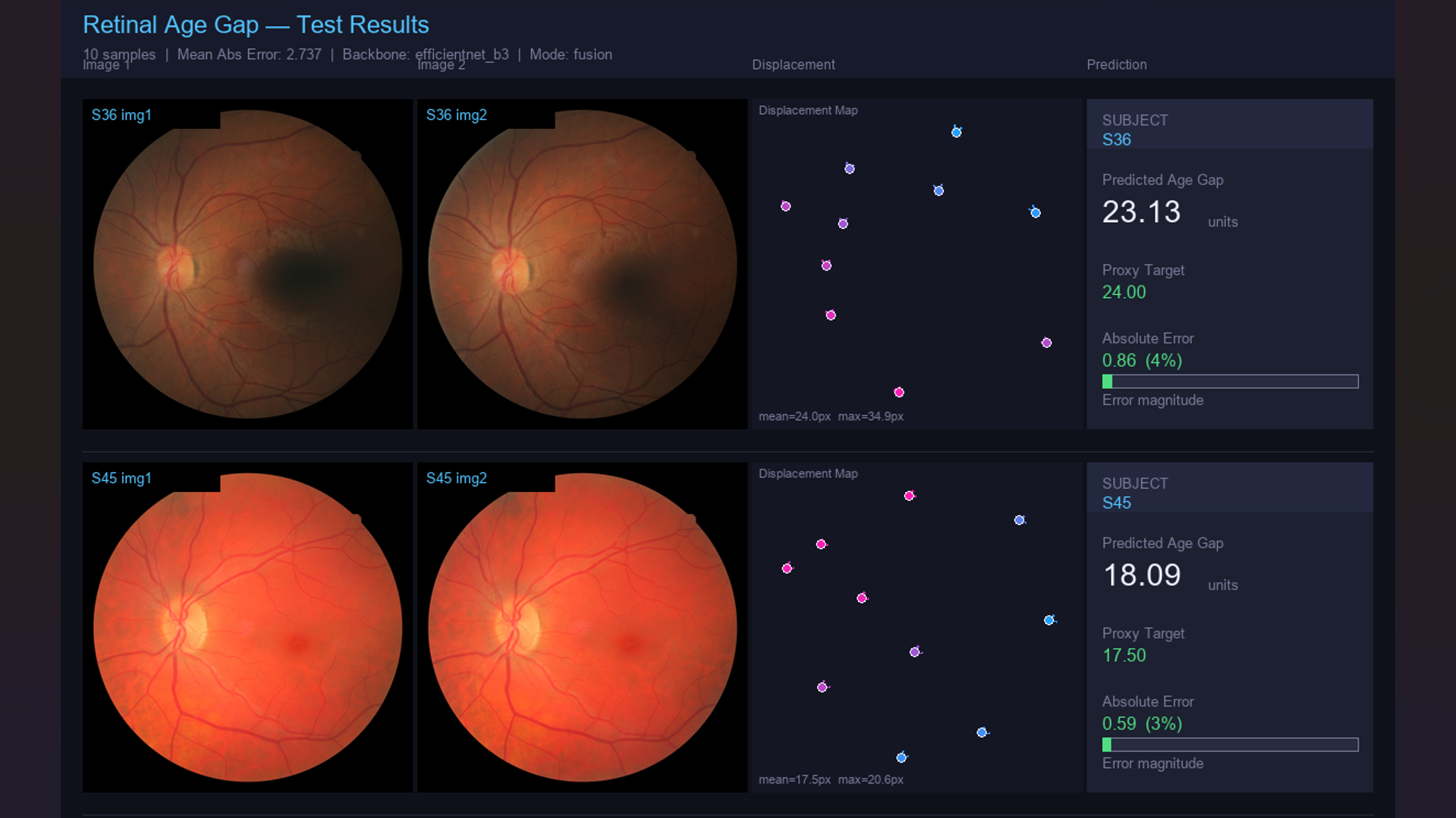 Retinal Vascular Age Estimation