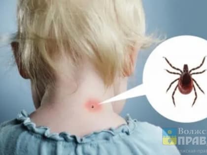 Волжанам напомнили о профилактике крымской геморрагической лихорадки