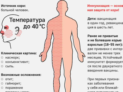 Как различить первые симптомы кори, рассказали волгоградцам
