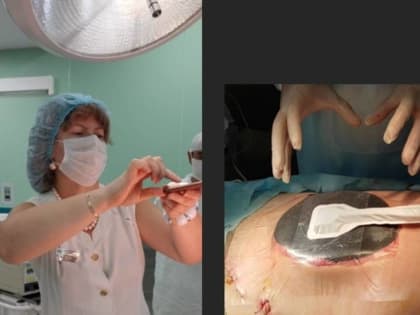 В Волгограде лечат сепсис по новому методу