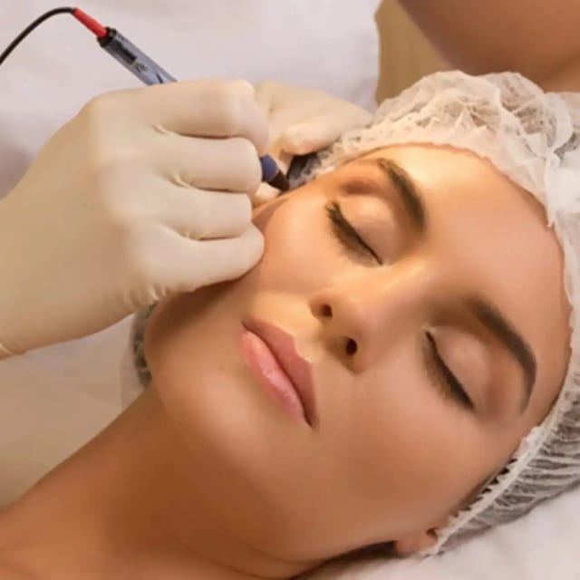 Electrolysis Permanent Hair Removal treatment.