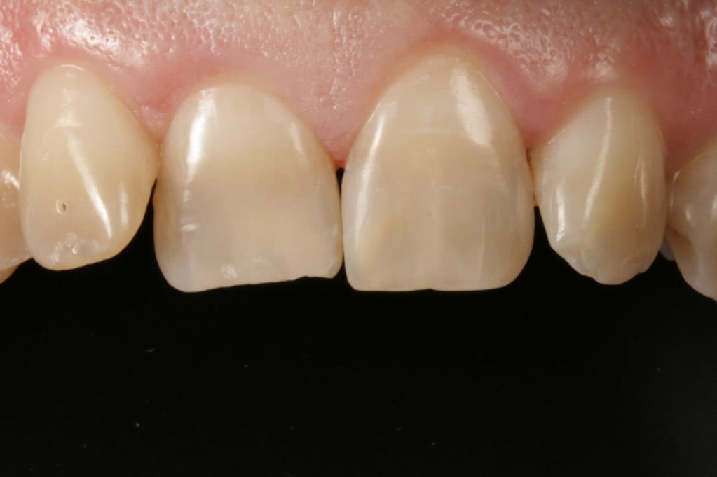 Estetika výměna starých výplní