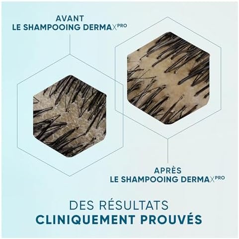 Vue 4 de Head Shoulder Dermaxpro Apaise