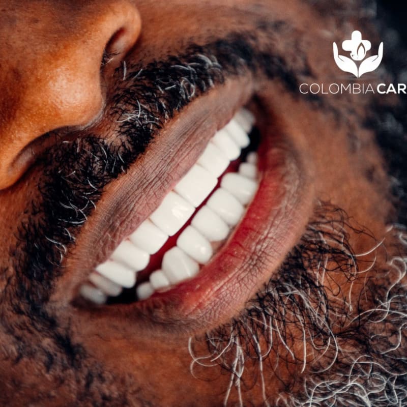 Porcelain veneers matched to a natural tooth shade, Colombia Care Dental, Medellín