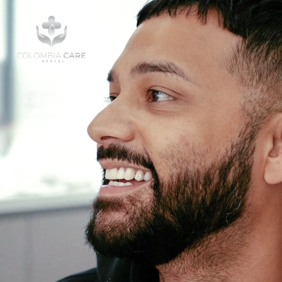Patient profile after porcelain veneers