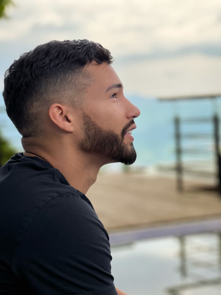 Gabriel's full beard after the transplant — Colombia Care, Medellín