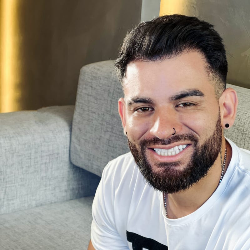 Jorge, paciente de FUE del grupo, tras su trasplante capilar